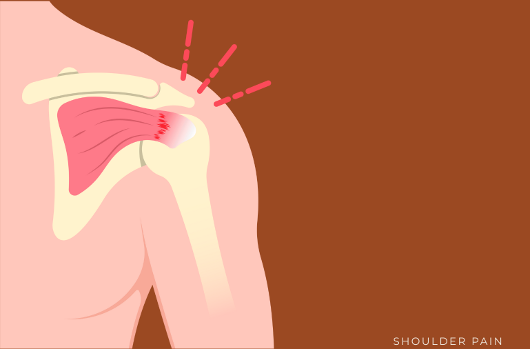 Best Shoulder Pain Specialist
